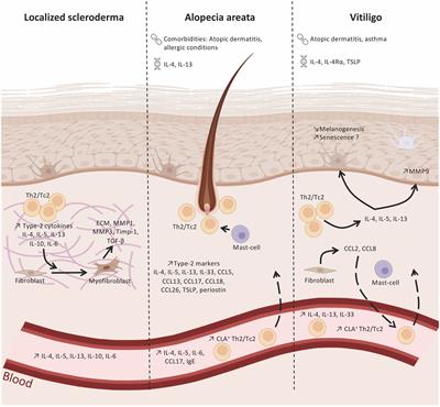 Type-2 immunity associated with type-1 related skin inflammatory diseases: friend or foe?